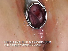 Amateurs Freyjaanalslut : Removing Her Iud - Pulling It Out Of Freyja's Cervix,  Making Her Fertile Again - Full Version On Manyv