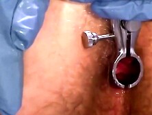 Doctor Tye examines a young boy's spilled load