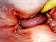 AMAZING INTERNAL SELF PERSPECTIVE. CAM INSIDE HER VAGINA WHILE I FILL HER WITH JIZZ