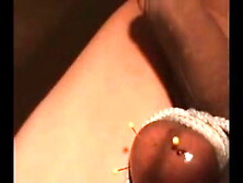 Testicles Skewered And Drained With Pins