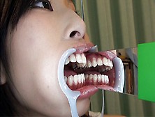 美人な女子の美しい歯並び、そしてキラリと光る銀歯を口内観察！ダイナミックで美形な鼻もGOODです