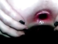 Huge butt hole enormous dildo in ass