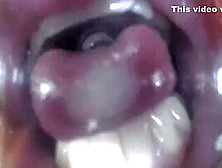 Mouthcam Jeana