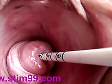 Extreme Real Cervix Fucking Insertion Asian Sounds and Objects in Uterus