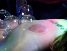 Fire Cupping and Electro Massage for Thin and Pale Model Sadie Quinn