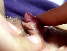 massive love button closeup