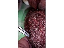 Maggots burrowed in balls part 1