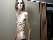 Anorexic Sonja 7