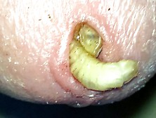 Bsf (Calciworm) Play