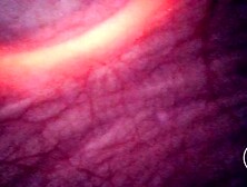 Look inside my Bladder as I push a Torch up my Booty Teaser