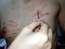 Small Breast being Cut