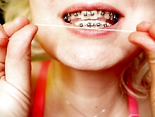 My 2nd day in braces: cleaning by dental floss