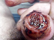 Maggot Mass