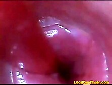 test tube shlong endoscope POV urethral insertion ball wang