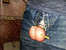 My friend put 3 needles in his testicles