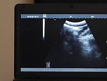 Ultrasound Whos How Dr.  Wolf's Cock Penetrates Austin Lock's Ass