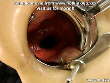 Hotkinkyjo in hot white dress & XO speculum in butt fuck long red dildo really deep