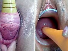 Lesbians Pee Hole Penetration and Cervix Fucking