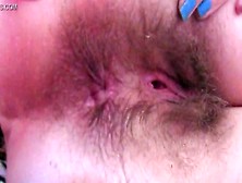 Hairy Ass Hole