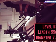 Rubnurse Agnes: colon dilatation + severe pegging