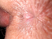 WIDE OPENED Pussy internal of 18 years old beautiful girl