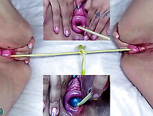 Prolapsed Cervix Lesbians at the same time