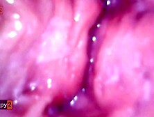 Creampie servix Camera inside Twat full of Jizz Multiorgasmic hotty FULL