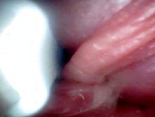 Endoscope camera shows the most sensitive parts of the penis Educational video