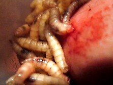 Maggots Making New Hole In My Glans