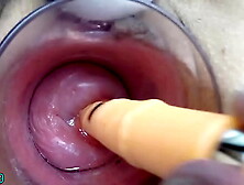 Thai Milf Cervix Fucking with German real dong dildo and thai chopsticks