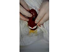 2 needles through my penis head