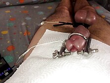 E-Stim With Urethral Stretcher