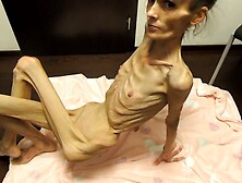 Anorexic Denisa 07-03-2022 8T00736