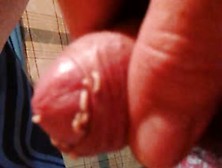 Maggots Under My Foreskin