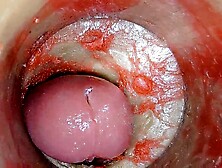 Camera Inside Unfathomable Snatch Captures Large dose Cumshot of Goo ASMR