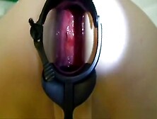 Ass gaped by huge speculum and dildo