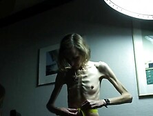 Anorexic Sonja 8T00366 31-07-2011