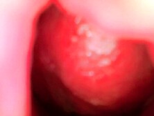 Best Camera Inside Pussy Porn - Huge Creampie In Blonde Model From Her Cervix’s POV - Couple