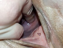 Cervix for Namsei (close-up)