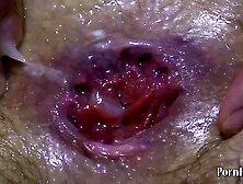 fisting and anal fisting,  lesbo fatties! Porn Movies - Tube8