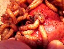 Maggots Eat Hole Into Frenum On Impotent Cock