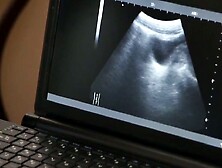 Sucractuting Hot Twink Ass Tall Doctor Fingers Petite Boys Prostate in SlowMo Carnal Tease!