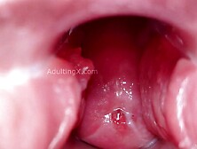 Cervix Display and Speculum Play