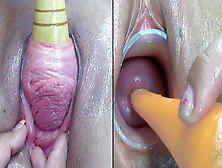 Lesbians Pee Hole Penetration And Cervix Fucking