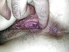 Wife Hairy Holes