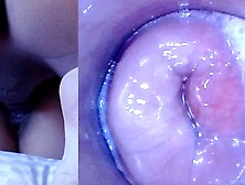 Vagina jizz,  Vagina webcam!! (Endoscope inside creampied twat)