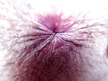 Butthole Exteme Closeup Butt Bizarre Butt Sex