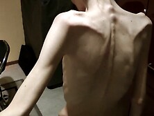 Anorexic Denisa 8T00564 01-08-2016