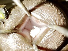 Fly laying eggs in my urethra part 4