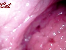 Endoscopic ♥vaginal observation